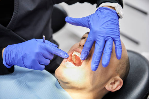 Best Broken or Chipped Tooth Repair in Dawson, GA